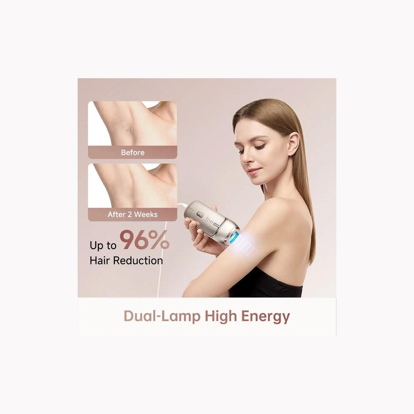 Dreame HAIR REMOVAL DEVICE IPL NOVA/AHR01-GOLD DREAME