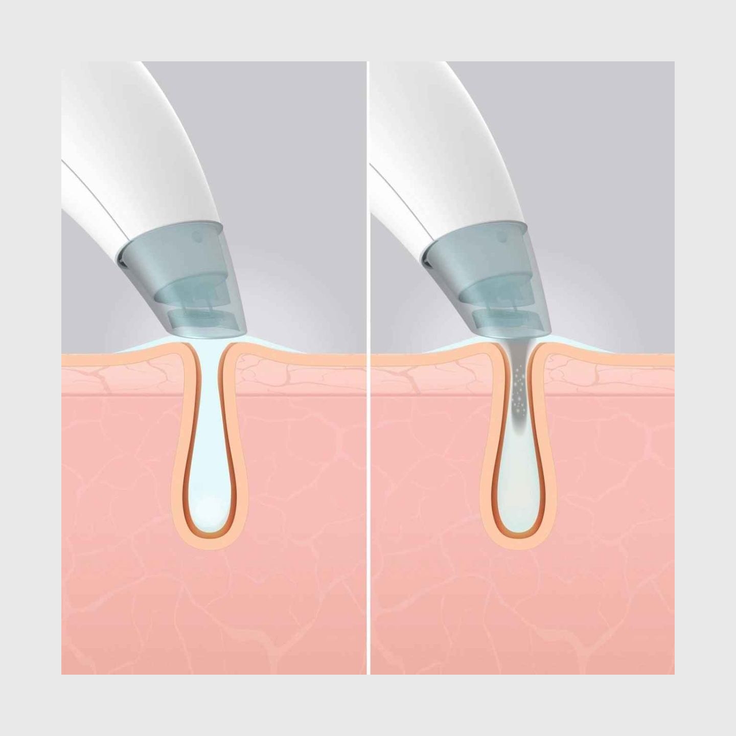 Homedics FAC-HY100 Refresh Hydra Facial