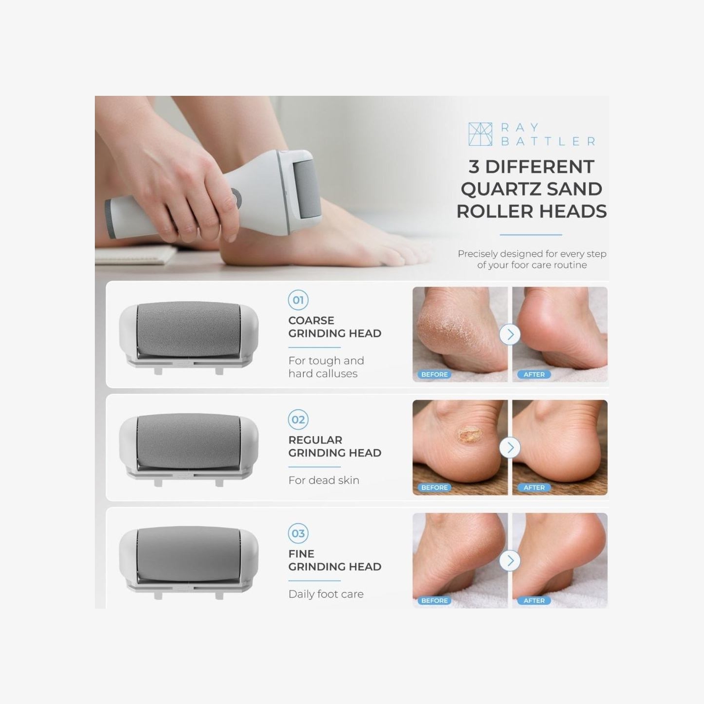 Ray Battler RB 0018 Callus Remover