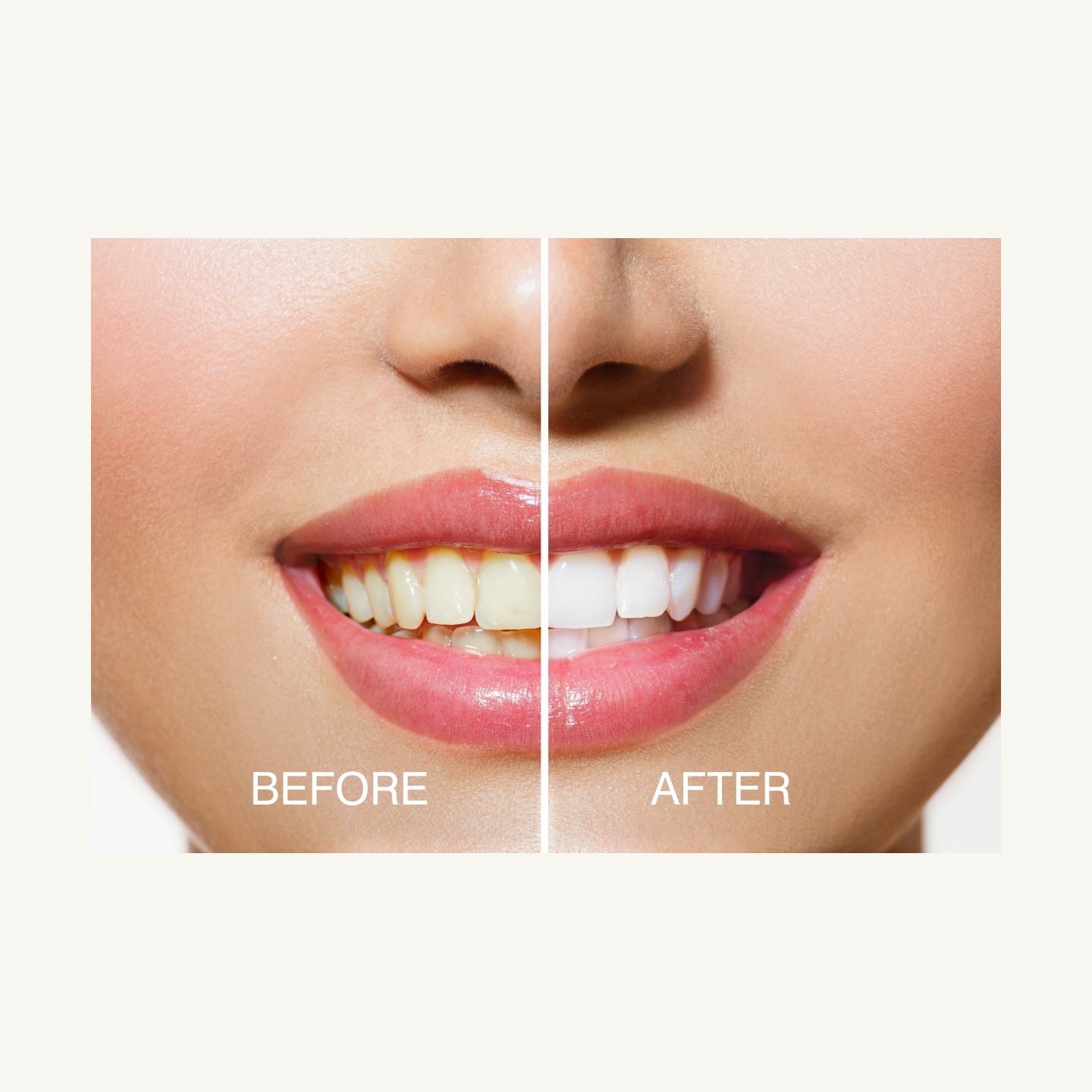 RIO DCWU-EU/1,6 USB Teeth Whitening