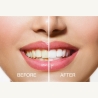 RIO DCWU-EU/1,6 USB Teeth Whitening