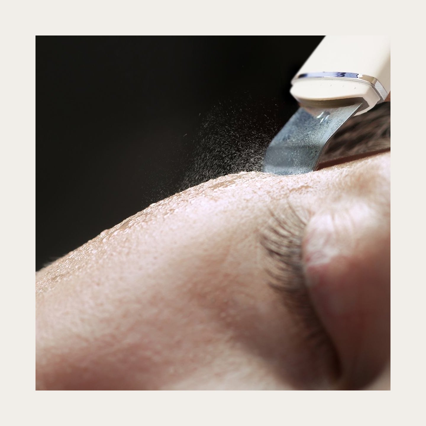 RIO FASC2-TOP-EU/1.1 Ultrasonic Skin Cleaner