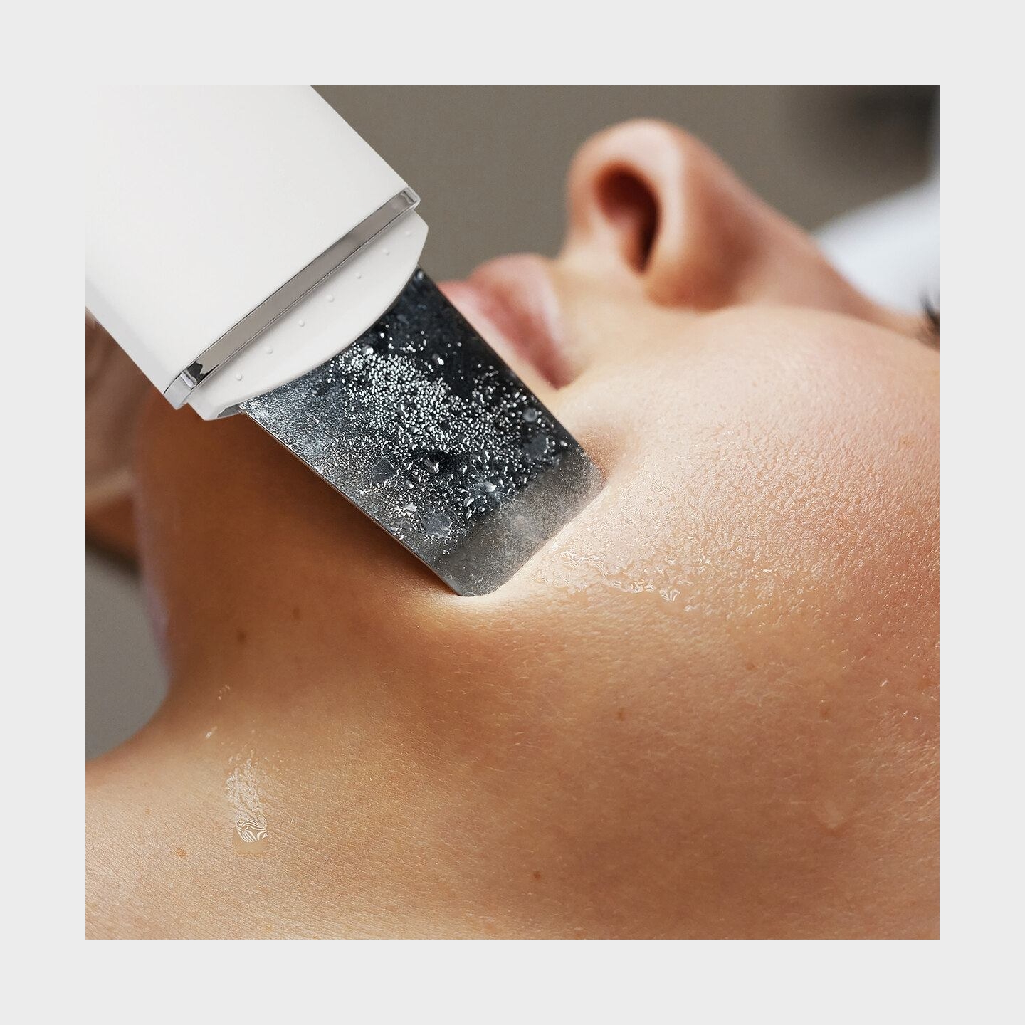 RIO FASC2-TOP-EU/1.1 Ultrasonic Skin Cleaner