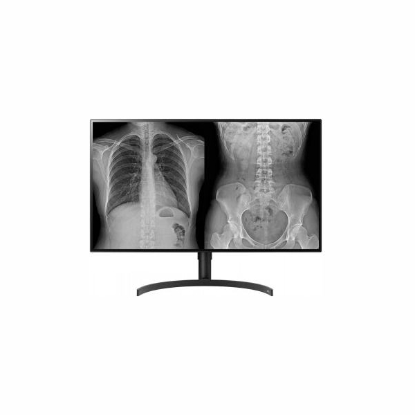 LG DIAGNOSTIC MONITOR, 31.5", 8MP, 450CD/M2, DCI-P3 98%, HAS/PIVOT.