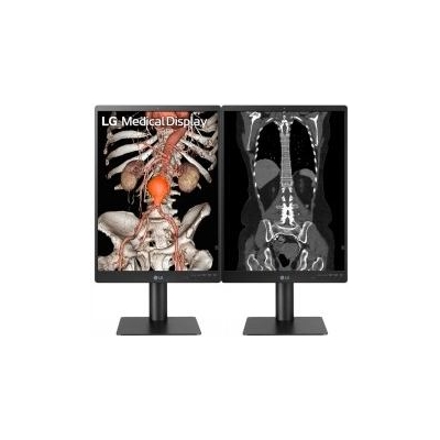 LG 21.3'' 3MP IPS DIAGNOSTIC MONITOR