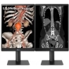 LG 21.3'' 3MP IPS DIAGNOSTIC MONITOR