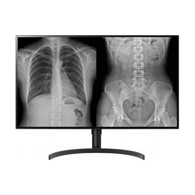 LG DIAGNOSTIC MONITOR, 31.5", 8MP, 450CD/M2, DCI-P3 98%, HAS/PIVOT.