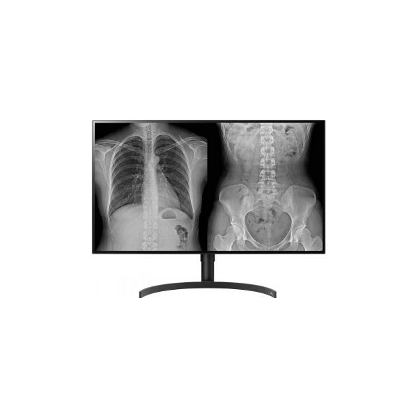 LG DIAGNOSTIC MONITOR, 31.5", 8MP, 450CD/M2, DCI-P3 98%, HAS/PIVOT.