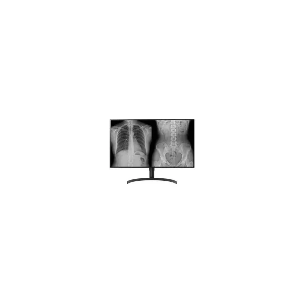 LG DIAGNOSTIC MONITOR, 31.5", 8MP, 450CD/M2, DCI-P3 98%, HAS/PIVOT.