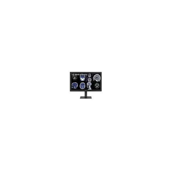 LG DIAGNOSTIC MONITOR, 31.5", 8MP, 1000CD/M2, SRGB100%, HAS, FRONT CALIBRATION SENSOR.